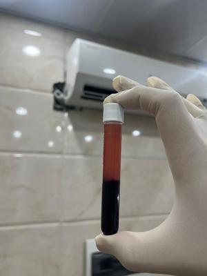PrP در قم