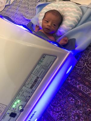 دستگاه های phototherapy led زردی نوزاد اجاره 22 منطقه در تهران