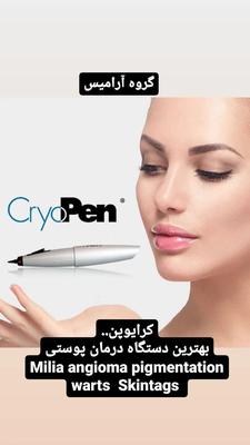 کرایوپن اصلی بلژیک درمان زگیل تناسلی در تهران