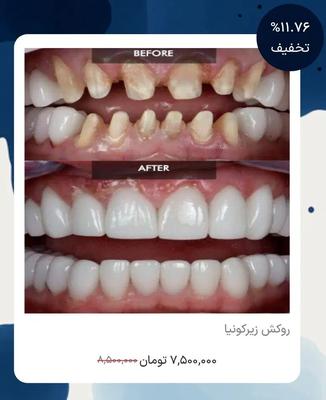خدمات کامل دندانپزشکی با تعرفه دولتی در تهران
