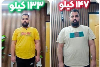 ۱۴ کیلو لاغری در یکماه با اسلیو معده بدون جراحی/
مطب لاغری وحید خانی در تهران
