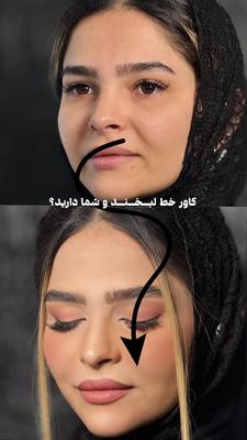 کلیه خدمات زیبایی در قم