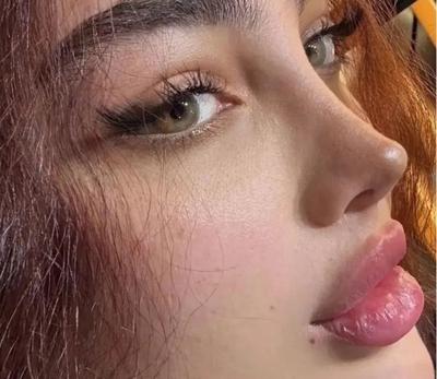 عمل جراحی زیبایی در قدس
