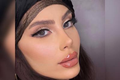 با دکتر علیجان با ۳۵ میلیون دوشنبه تضمینی عمل شو در تهران