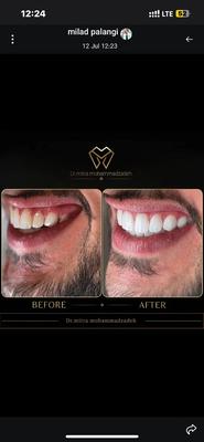 کامپوزیت ماهیانه  ۲۸۰۰ اقساطی ۱۲ ماهه در اسلامشهر