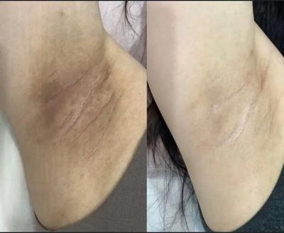 روشن کنندگی نواحی تیره در گنبد کاووس