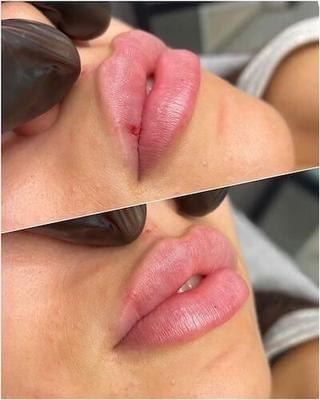 خدمات تخصصی تزریق ژل و بوتاکس در پردیس
