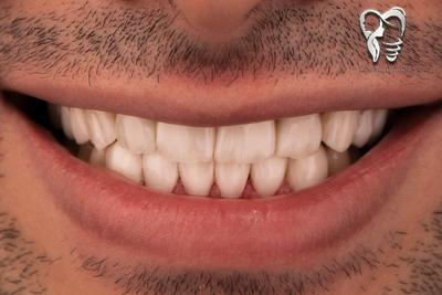 دندانپزشکی اقساط تا ۱۲ ماه (بدون سود) در اراک