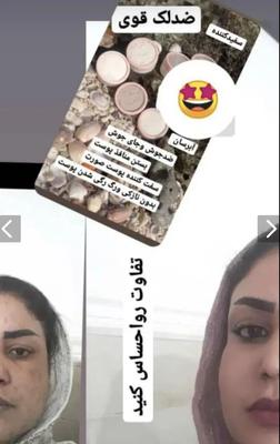 پاکسازی پوست دایمی ضدلک سفیدکننده تضمینی در تهران