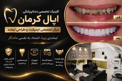 ایمپلنت دیجیتال کرمان اقساط گارانتی معتبر در کرمان