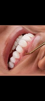 دندانپزشکی اقساط ۴ماهه بدونِ کارمزد در یزد