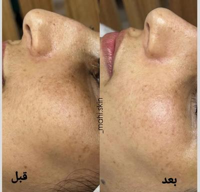 نیازمند مدل فقط با هزینه ی مواد برای تکمیل البوم در ماهشهر