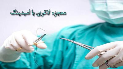 امبیدینگ فقط ۵میلیون وهردستگاه لاغری۱۹۹ هزار تومان در اصفهان