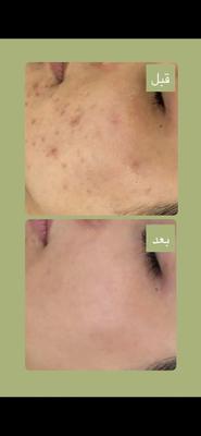 فیشال تخصصی با برند تالاک فرانسه در کرج