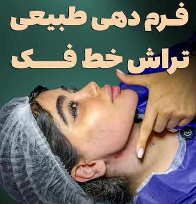 ساکشن غبغب ، بلفاروپلاستی در تهران