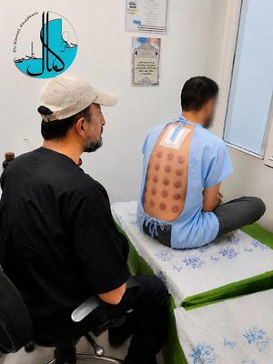 کلینیک تخصصی حجامت دکتر کمال خادمی در تهران