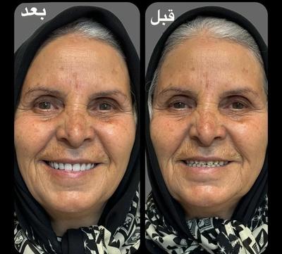 مرکز ساخت تخصصی دندان مصنوعی،دندانسازی باضمانت در یزد