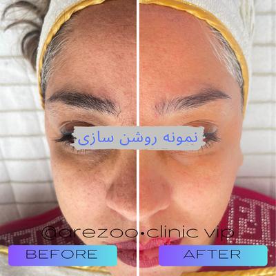 فیشال تخصصی و درمانی در اصفهان