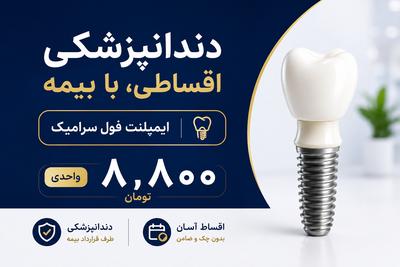 دندانپزشکی اقساطی، با بيمه ایمپلنت فول سرامیک واحدی ۸،۸۰۰ در تهران
