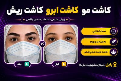 کلینیک تخصصی پوست و مو ماهتیسا . مشاوره رایگان در ساری