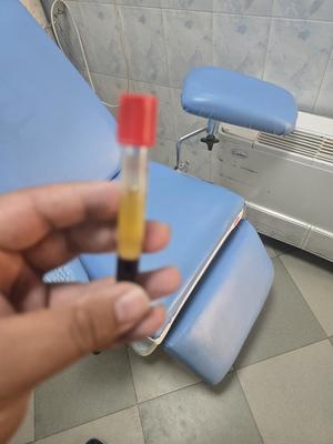 پی ار پی تقویت مو و ابرو و مشکلات آرتروز علمی و اثبات شده در مشهد