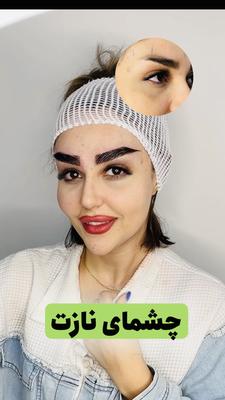 طراحی متناسب با چهره شما(طراحی لیفت شقیقه) در شیراز