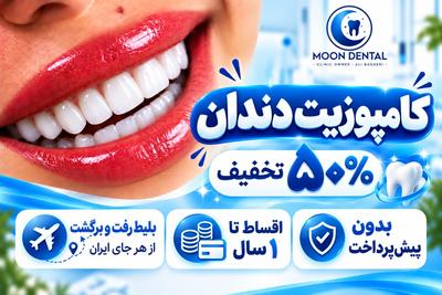 🦷کامپوزیت دندان🦷✨ ۵۰٪ تخفیف بلیط رفت وبرگشت از هر جای ایران
