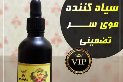 رفع سفیدی مو سر سفیدی ریش و ابرو ((((تضمینی))))) در گرگان
