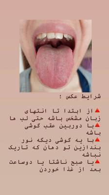 ایستگاه سلامتی در تاکستان