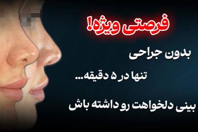 بدون درد،خونریزی و دوران نقاهتتوسط دکتر شیبانی با ۳۰ سال تجربه 🩵 در تهران