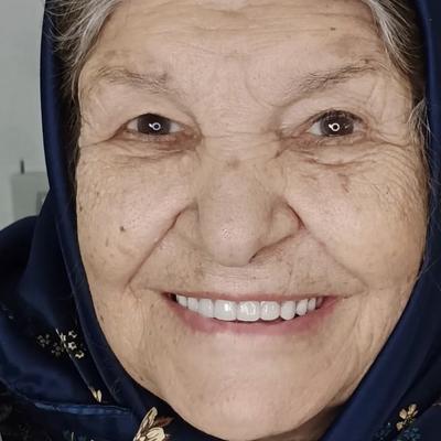 دندان مصنوعی ژاپنی در شیراز