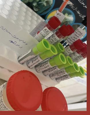 آزمایش خون🩸💉 در رشت