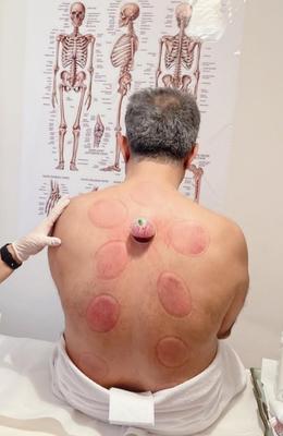 حجامت و خدمات تخصصی طب سنتی در اصفهان