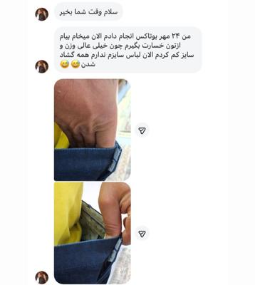 با بوتاکس معده کاهش سایز رو تجربه کنین در کرمان
