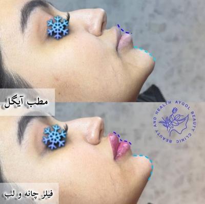 مطب زیبایی آیگل در اصفهان