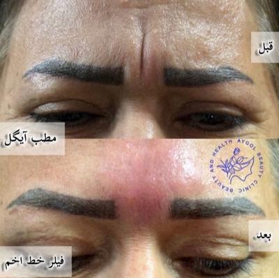 مطب زیبایی آیگل در اصفهان