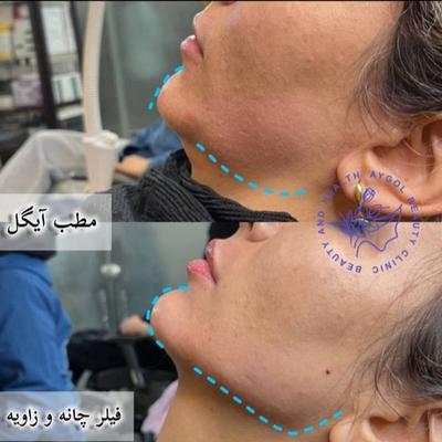 مطب زیبایی آیگل در اصفهان