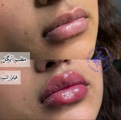 مطب زیبایی آیگل در اصفهان