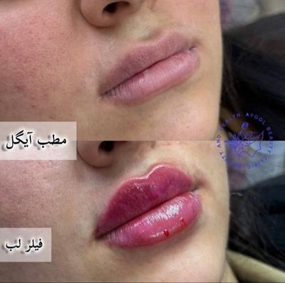 مطب زیبایی آیگل در اصفهان