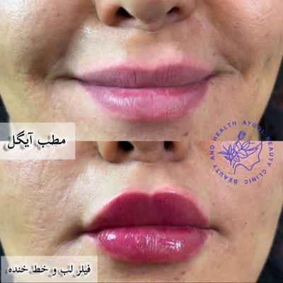 مطب زیبایی آیگل در اصفهان
