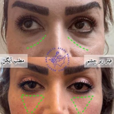 مطب زیبایی آیگل در اصفهان