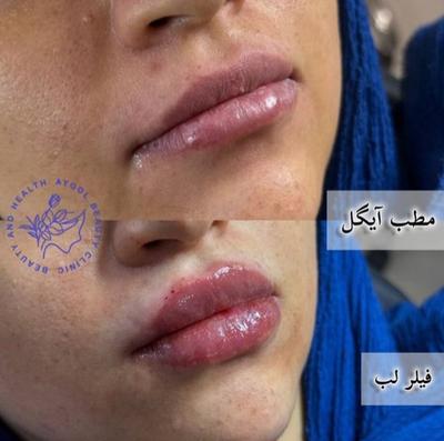 مطب زیبایی آیگل در اصفهان