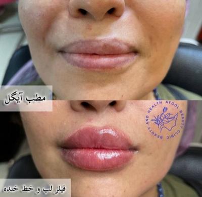 مطب زیبایی آیگل در اصفهان