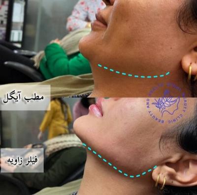 مطب زیبایی آیگل در اصفهان