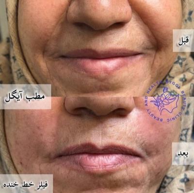 مطب زیبایی آیگل در اصفهان