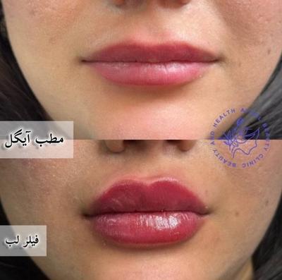 مطب زیبایی آیگل در اصفهان