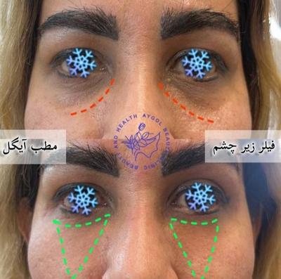 مطب زیبایی آیگل در اصفهان