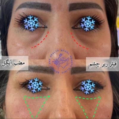 مطب زیبایی آیگل در اصفهان