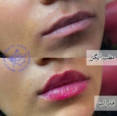 مطب زیبایی آیگل در اصفهان