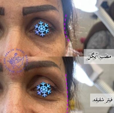 مطب زیبایی آیگل در اصفهان